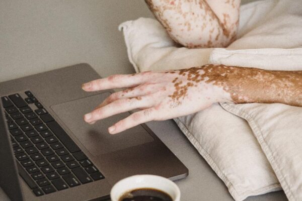 "יחסי מין: מה שאתה צריך לדעת כדי להישאר בטוח"